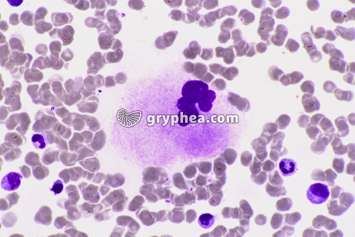 Mégacaryocyte x400 - gryphea.org